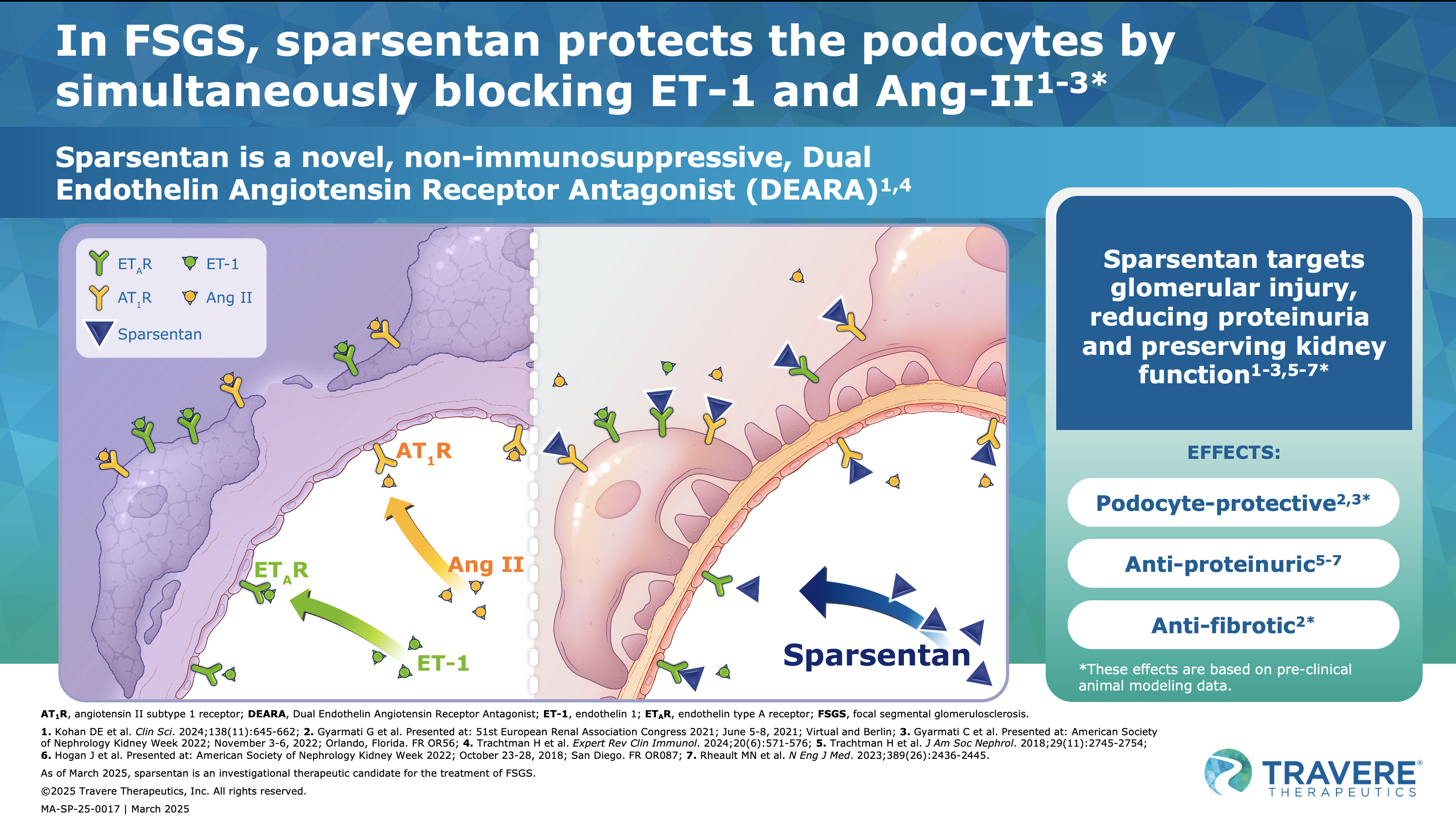 FSGS: Explore the sparsentan mode of action