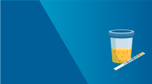Proteinuria in urine cup